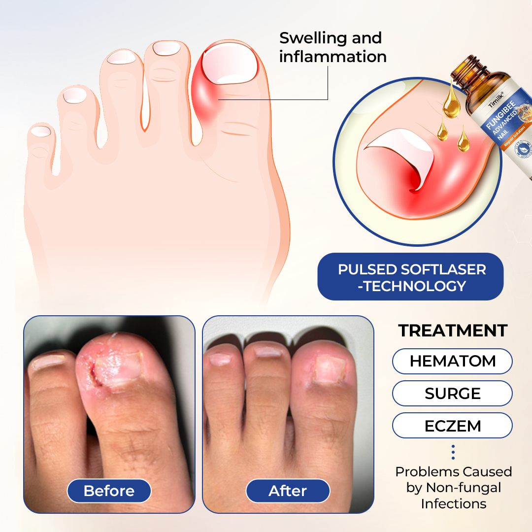Timilk® FungiBee Advanced Nail Repair Solution