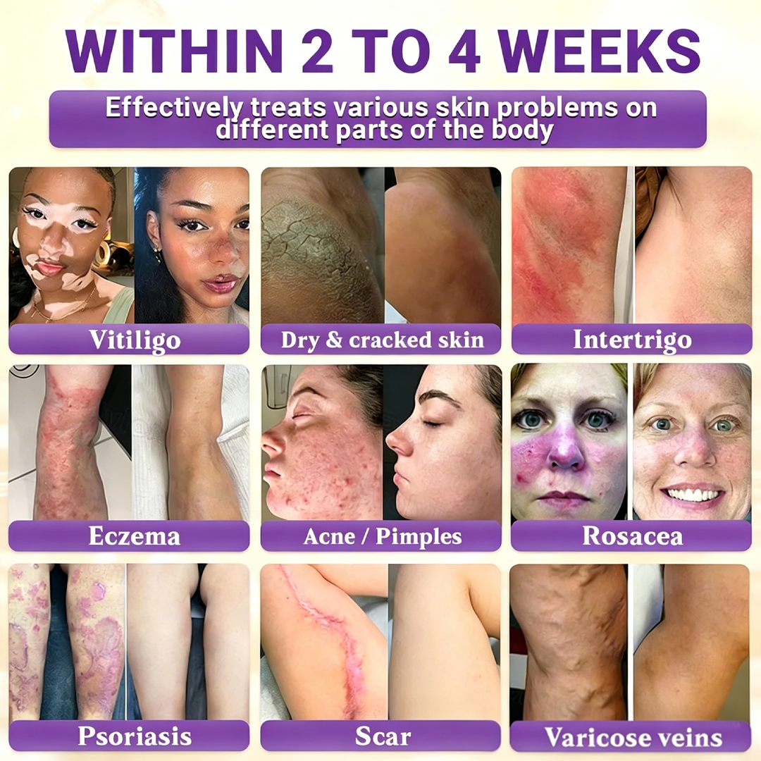 Timilk® Biotin 10-in-1 Skin Restoration Cream