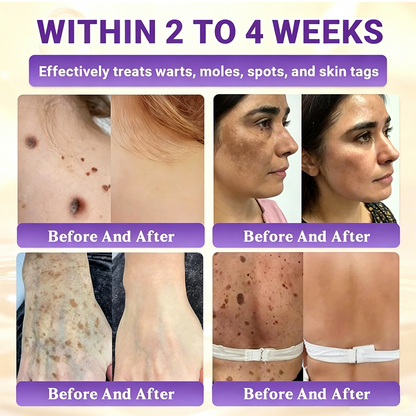 Timilk® Biotin 10-in-1 Skin Restoration Cream