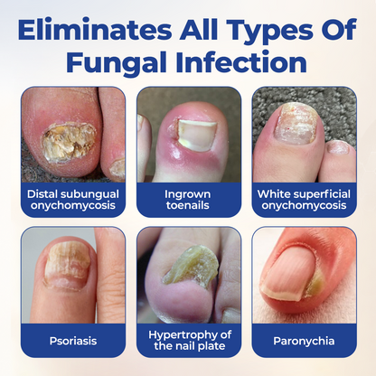 Timilk® FungiBee Advanced Nail Repair Solution